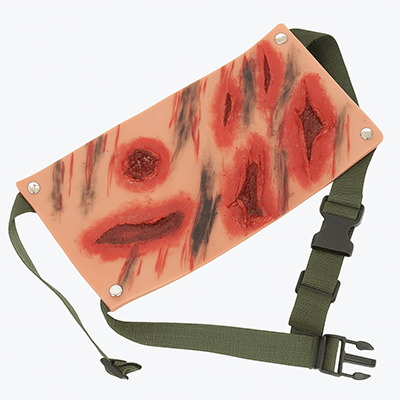 Wrap-Around Abdominal Shrapnel Wound SHRAPWOUND